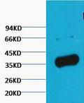 Anti-GAPDH antibody (STJA0006704) – Figure 1 of 1