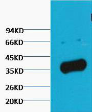 Anti-GAPDH antibody (STJA0006704) – Figure 1 of 1