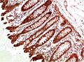 Anti-ATM antibody (STJA0006705) – Figure 1 of 1