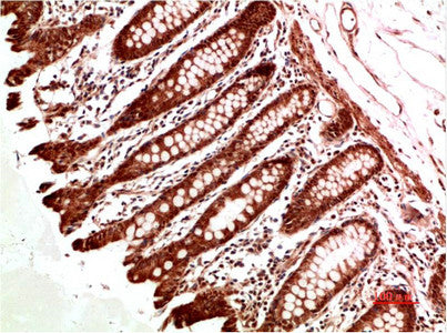 Anti-ATM antibody (STJA0006705) – Figure 1 of 1