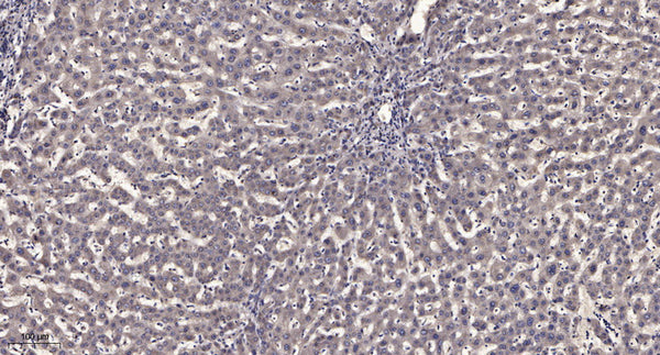 Anti-ATG13 antibody (STJA0006706) – Figure 1 of 1