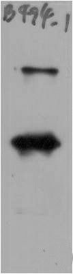 Anti-SARS-COV-2 Spike Protein antibody (STJA0006719) – Figure 1 of 1