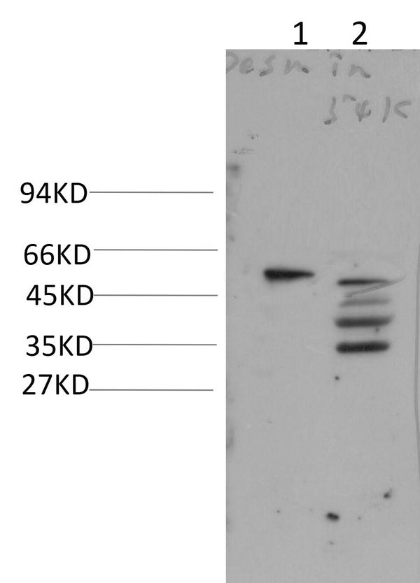 Anti-DES antibody (197-247) (STJA0006724) – Figure 1 of 1