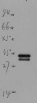 Anti-mScarlet antibody (STJA0006726) – Figure 1 of 1