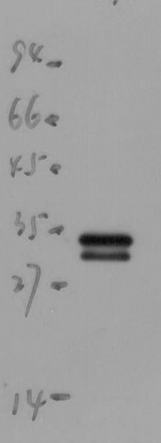 Anti-mScarlet antibody (STJA0006726) – Figure 1 of 1