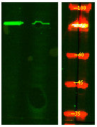 Anti-Phospho-BACE1-Ser498 antibody (STJA0009813) – Figure 1 of 1