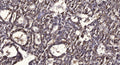 Anti-Phospho-PPARA-Ser21 antibody (STJA0009830) – Figure 1 of 1