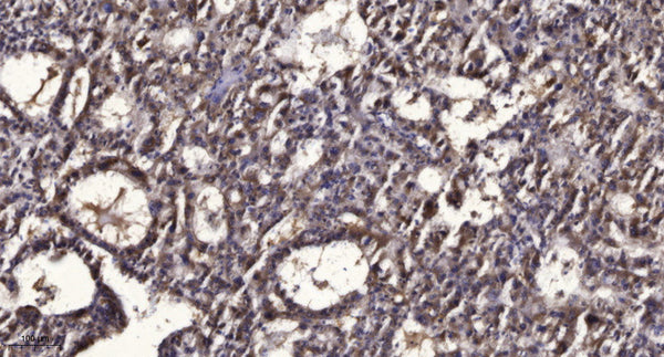 Anti-Phospho-PPARA-Ser21 antibody (STJA0009830) – Figure 1 of 1