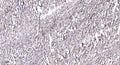 Anti-Phospho-SMAD2-Ser245 antibody (STJA0009833) – Figure 1 of 1