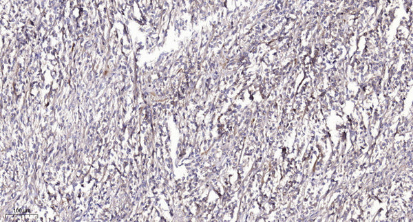 Anti-Phospho-SMAD2-Ser245 antibody (STJA0009833) – Figure 1 of 1