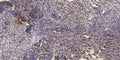 Anti-Phospho-ITPR1-Tyr353 antibody (STJA0009850) – Figure 1 of 1