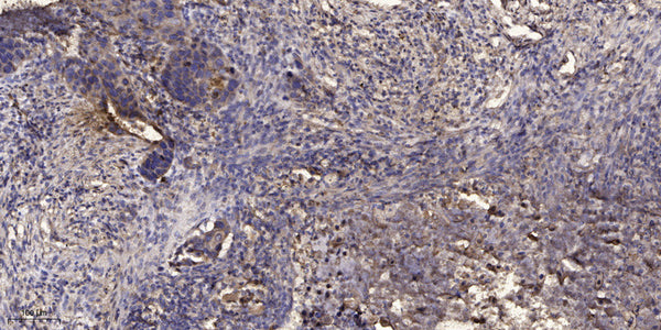 Anti-Phospho-ITPR1-Tyr353 antibody (STJA0009850) – Figure 1 of 1