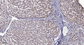 Anti-Phospho-LRP6-Thr1479 antibody (STJA0009851) – Figure 1 of 1