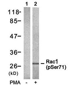 Anti-Phospho-RAC1-Ser71 antibody (STJA0009870) – Figure 1 of 1
