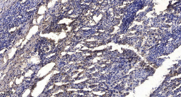 Anti-SIRT1 antibody (STJA0009872) – Figure 1 of 1