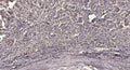 Anti-Phospho-PDK1-Thr338 antibody (STJA0009880) – Figure 1 of 1
