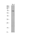 Anti-Phospho-FGR-Tyr412 antibody (STJA0009900) – Figure 1 of 1