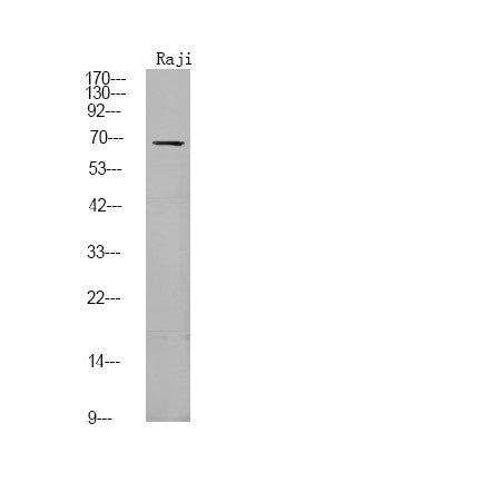 Anti-Phospho-FGR-Tyr412 antibody (STJA0009900) – Figure 1 of 1