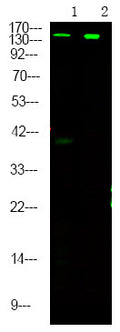 Anti-Phospho-RPTOR-Ser863 antibody (STJA0009908) – Figure 1 of 1