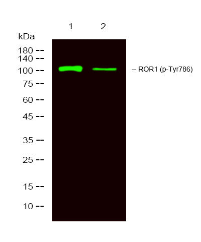 Anti-Phospho-ROR1-Tyr786 antibody (STJA0009911) – Figure 1 of 1