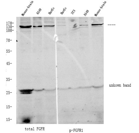 Anti-Phospho-FGFR1-Tyr653+Tyr654 antibody (STJA0009929) – Figure 1 of 1