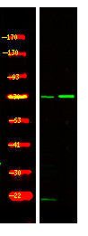 Anti-Phospho-SRPK1-Thr601 antibody (STJA0009934) – Figure 1 of 1