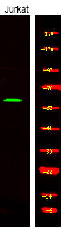 Anti-Phospho-CAMKK1-Ser458/495 antibody (STJA0009937) – Figure 1 of 1