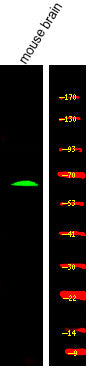 Anti-Phospho-CRMP1-Tyr504 antibody (STJA0009970) – Figure 1 of 1