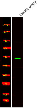 Anti-Phospho-NR5A1-Ser203 antibody (STJA0009976) – Figure 1 of 1