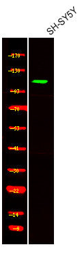 Anti-Phospho-TNK2-Tyr857+Tyr858 antibody (STJA0009977) – Figure 1 of 1