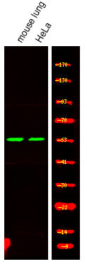 Anti-Phospho-MAZ-Thr72 antibody (STJA0009984) – Figure 1 of 1