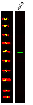 Anti-Phospho-EIF5-Ser389+Ser390 antibody (STJA0009987) – Figure 1 of 1