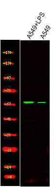 Anti-Phospho-CAVIN1-Tyr156 antibody (STJA0009988) – Figure 1 of 1