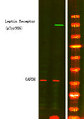 Anti-Phospho-LEPR-Tyr986 antibody (STJA0010018) – Figure 1 of 1