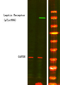 Anti-Phospho-LEPR-Tyr986 antibody (STJA0010018) – Figure 1 of 1