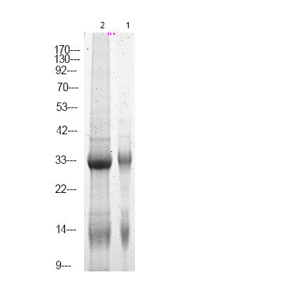 Anti-Phospho-NPM1-Ser70 antibody (STJA0010019) – Figure 1 of 1