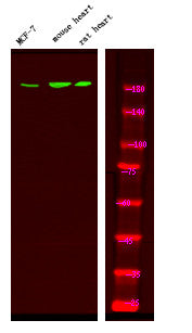 Anti-Phospho-ERBB4-Tyr1242 antibody (STJA0010023) – Figure 1 of 1