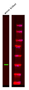 Anti-Phospho-PSEN1-Ser353 antibody (STJA0010028) – Figure 1 of 1