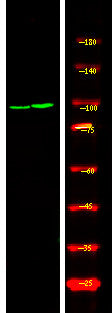 Anti-Phospho-RBBP8-Ser664 antibody (STJA0010034) – Figure 1 of 1