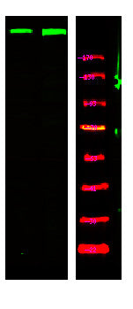 Anti-Phospho-ATM-Ser367 antibody (STJA0010035) – Figure 1 of 1