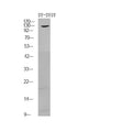 Anti-Phospho-FGFR1-Tyr730/733 antibody (STJA0010039) – Figure 1 of 1