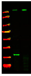 Anti-Phospho-TSC2-Ser981 antibody (STJA0010040) – Figure 1 of 1