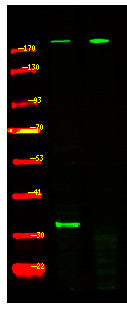 Anti-Phospho-TSC2-Ser981 antibody (STJA0010040) – Figure 1 of 1