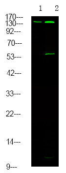 Anti-Phospho-MET-Tyr1313 antibody (STJA0010050) – Figure 1 of 1