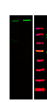 Anti-Phospho-ATM-Ser179 antibody (STJA0010053) – Figure 1 of 1