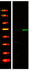 Anti-Phospho-FOXO3-Ser321 antibody (STJA0010059) – Figure 1 of 1