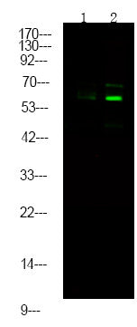 Anti-Phospho-BECN1-Ser93/96 antibody (STJA0010075) – Figure 1 of 1