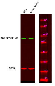Anti-Phospho-FER-Tyr714 antibody (STJA0010076) – Figure 1 of 1