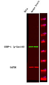Anti-Phospho-G3BP1-Ser149 antibody (STJA0010081) – Figure 1 of 1