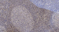 Anti-PSMA3 antibody (190-270) (STJA0010090) – Figure 1 of 1